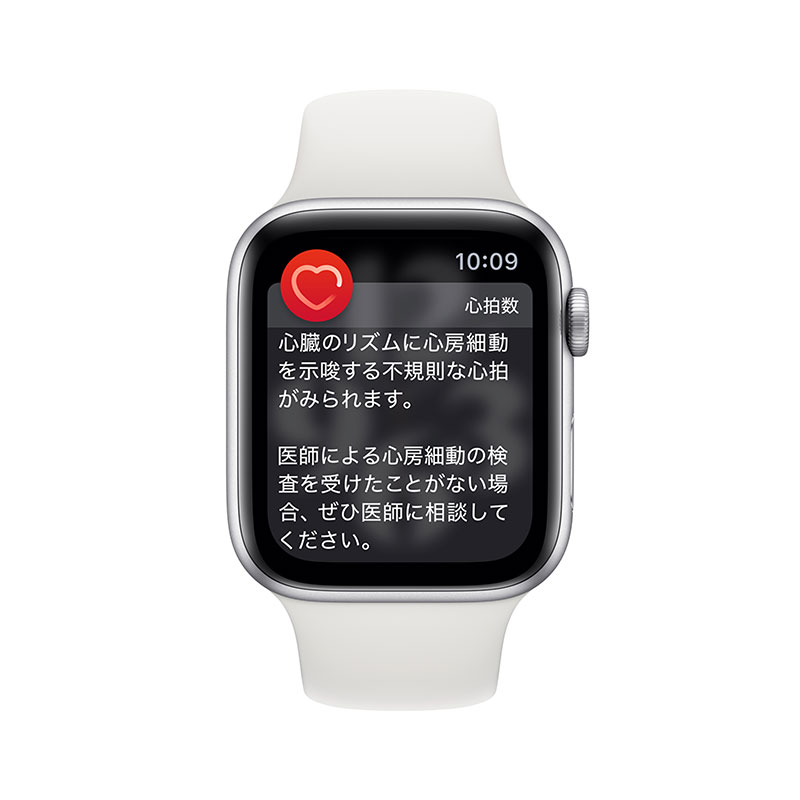 Apple Watchの不規則な心拍の通知機能